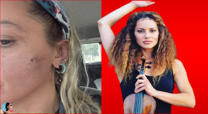 EŞİM TARAFINDAN DARP EDİLDİM