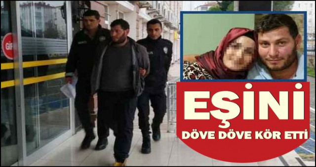 10 YILLIK EŞİNİ TEKME TOKAT DÖVE DÖVE KÖR ETTİ