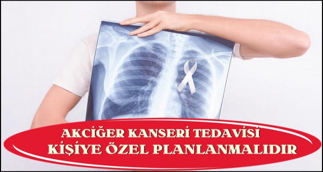 AKCİĞER KANSERİ TEDAVİSİ KİŞİYE ÖZEL PLANLANMALIDIR